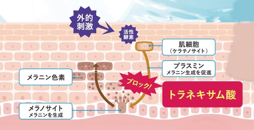 トラネキサム酸