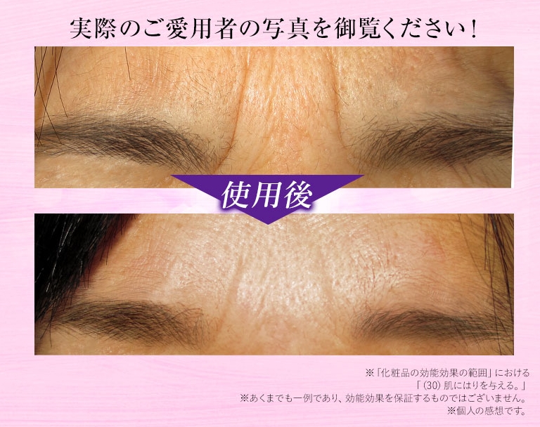 眉間の変化