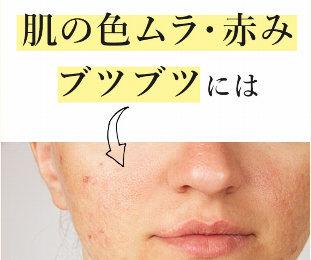 悪い口コミ