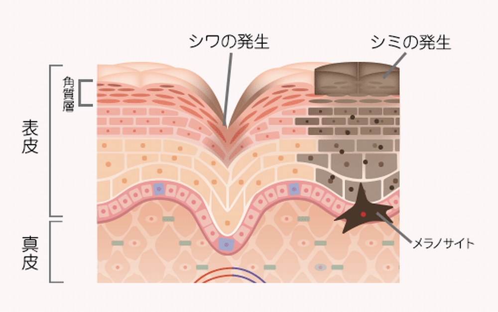 シワの表皮と真皮