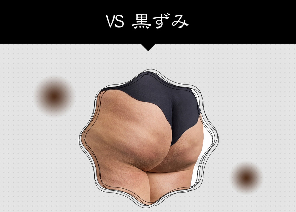 黒ずみ