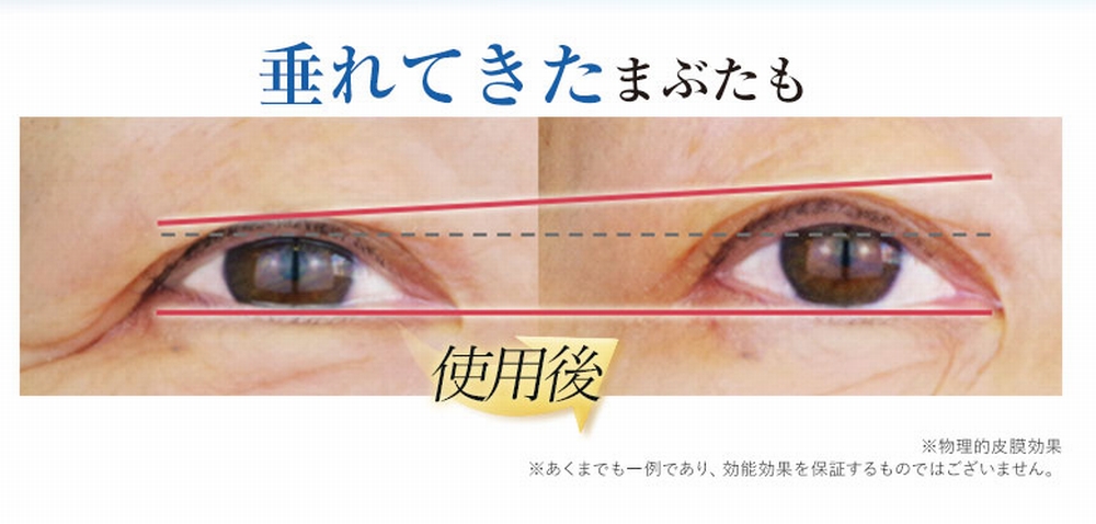 垂れてきたまぶた