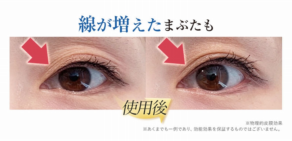 線が増えたまぶた