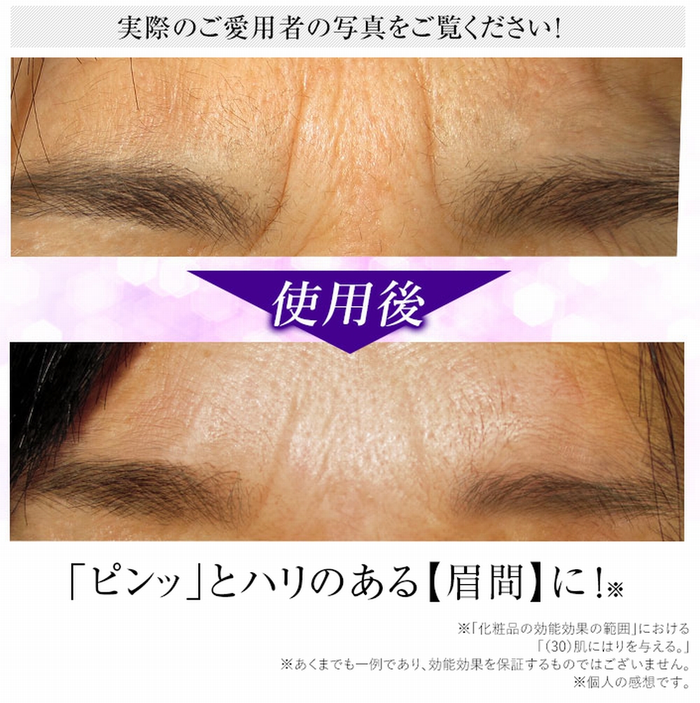 眉間のシワ用パッチに近い商品の良い口コミ