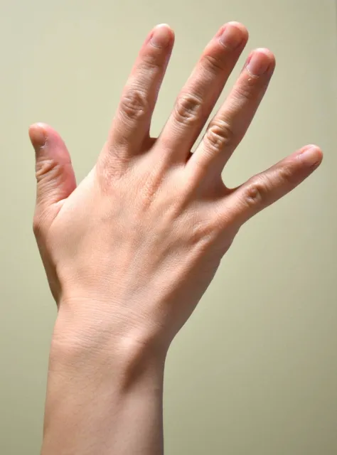 手の血管が浮き出る原因は?【女性】